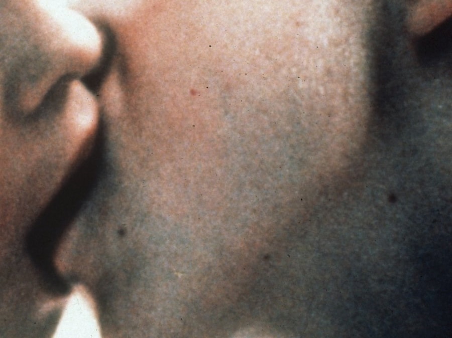kiss