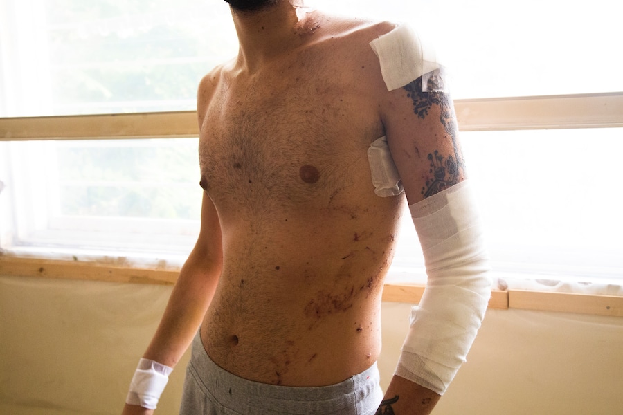 Beirut after the blast 2 1