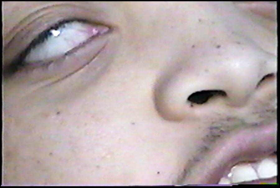 ‘Blind Beauty’ 3