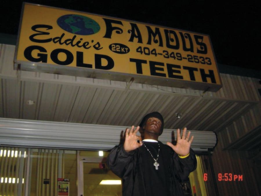 mouth-full-of-golds-dazed
