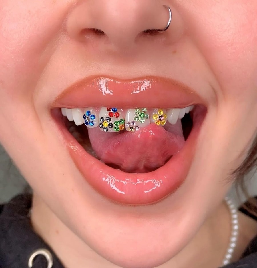 Tooth gems by Graciella Masterton 4