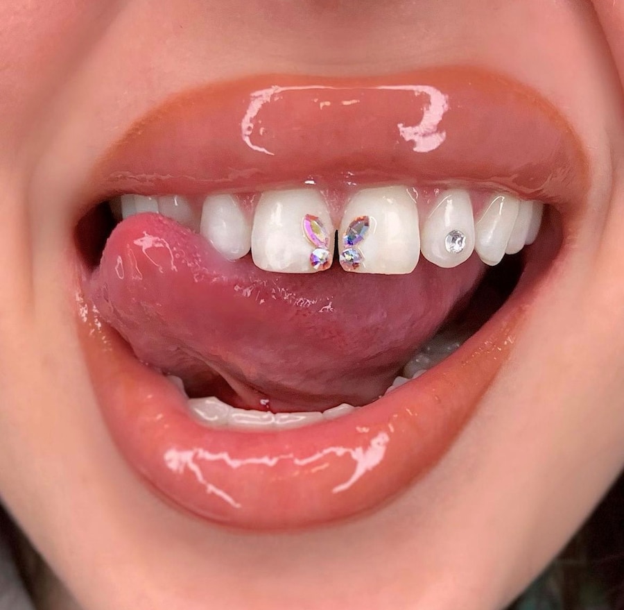 Tooth gems by Graciella Masterton 8