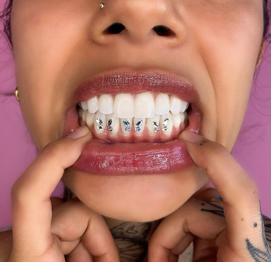 Tooth gems by Graciella Masterton 3