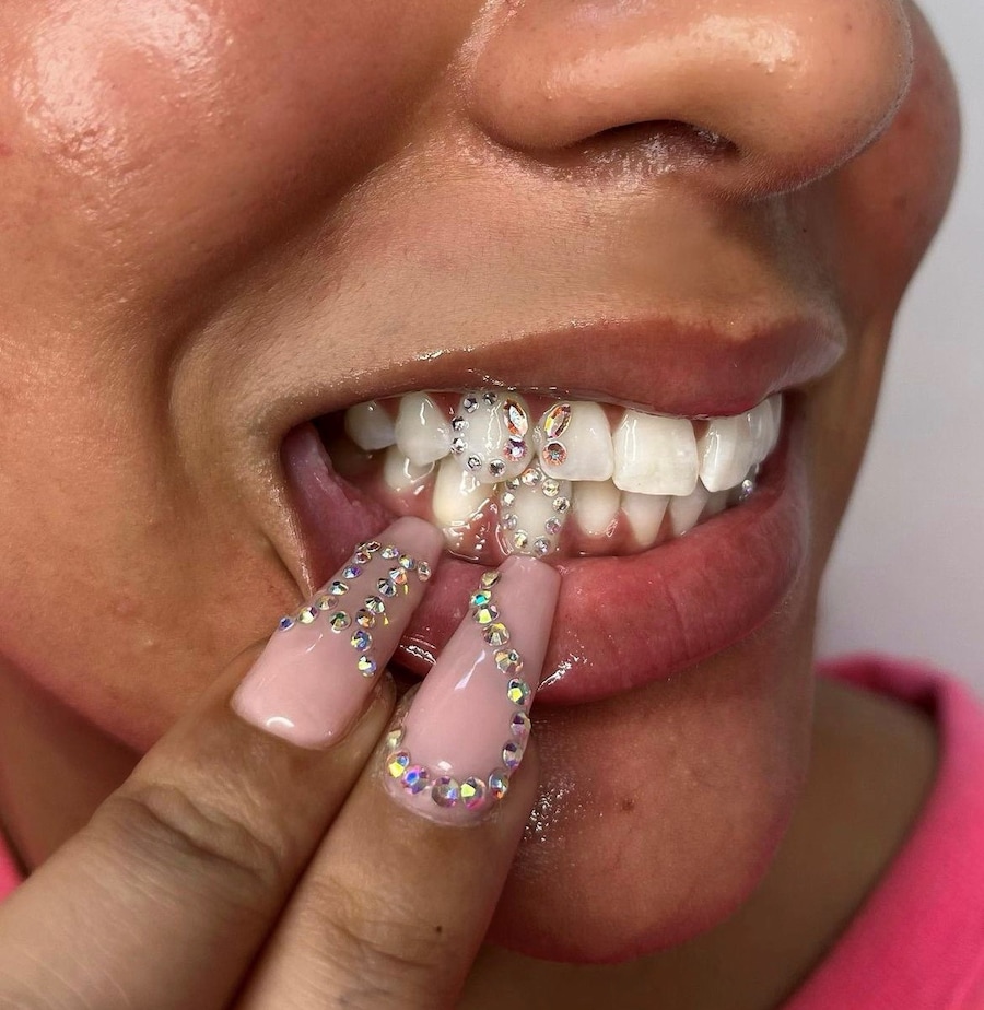 Tooth gems by Graciella Masterton 5