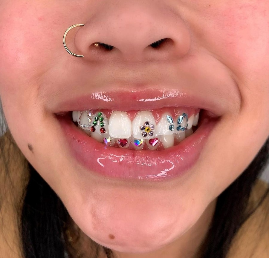 Tooth gems by Graciella Masterton 13