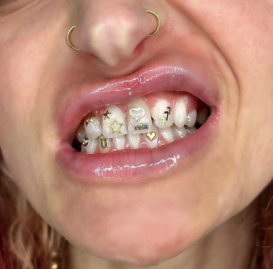 Tooth gems by Graciella Masterton 14