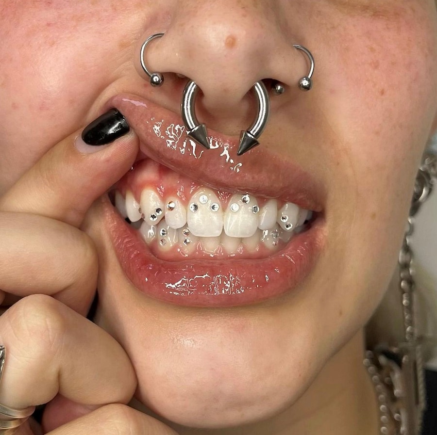 Tooth gems by Graciella Masterton 15