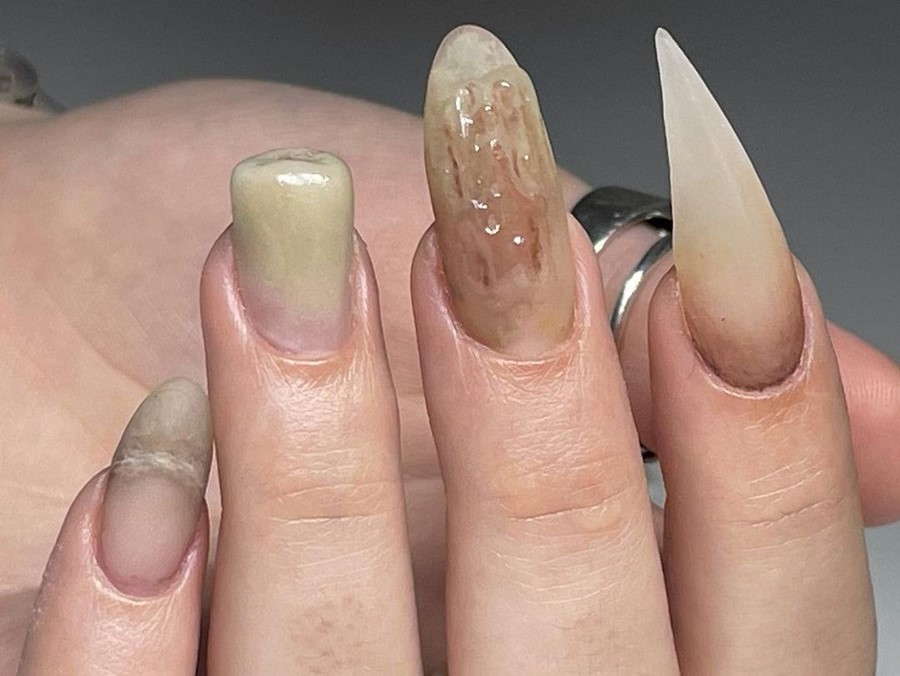 Woman Issues Warning As She Shares Shocking Result of Gel Manicure—'Damage'