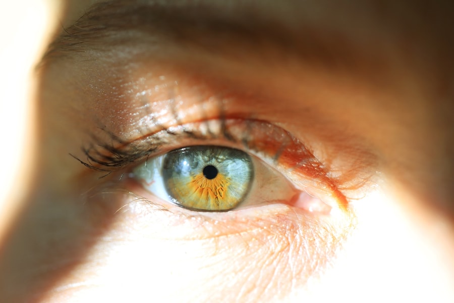 EYE_SKY-76 6