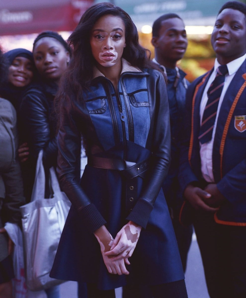 Winnie Harlow in the Winter 2014 issue of Dazed